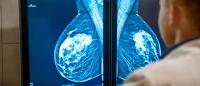 A physician looks at a mammogram on a computer screen.
